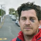 Jared Hunter Mason is still recovering from the injuries he sustained in the incident.