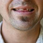 People reported that their oral health was causing them psychological and physical pain and...