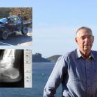 Dunedin man Walter Dalziel was left with 21 broken bones and a range of other injuries after a...