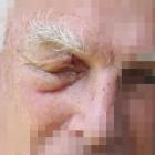 Prebbleton assault victim, John. Photo: Supplied