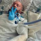 Kevin Burney in Middlemore Hospital's specialist burns unit in April. Photo: Supplied