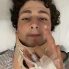 Luke Hickling was in the trauma unit at Christchurch Hospital for three nights following his...