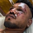 Crash survivor Ramesh Viswashkumar. Photo: Twitter