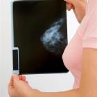 AI will be used as a second set of eyes reading breast cancer scans from early next year. File photo
