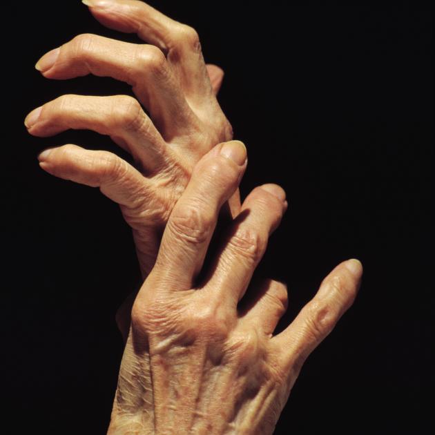 Older people can face issues with malnutrition for a variety of reasons. Photo: Getty Images