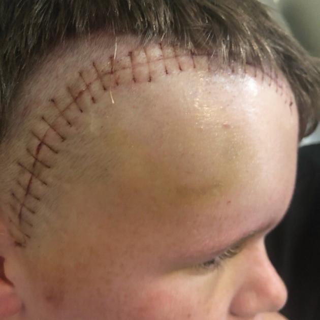 Jayden was taken by ambulance to Christchurch Hospital after being hit by the arm of a roto...