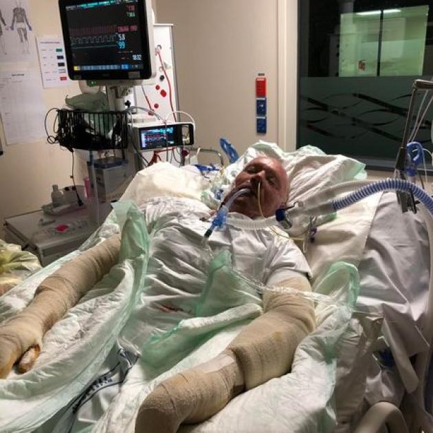 Kevin Burney in intensive care in Auckland after the explosion. Photo: Supplied
