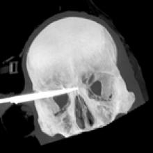 SCCZEN_160213HOSSPLKNIFE1_220x147.jpg