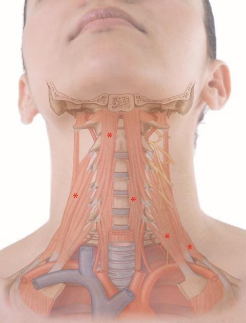 Understanding muscles: a clue to avoid being a pain in the neck