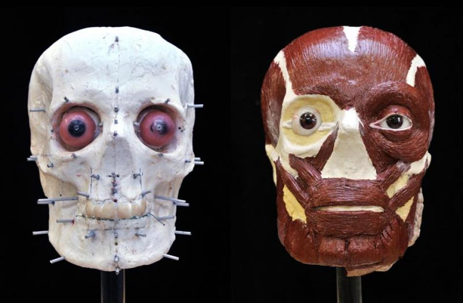Steps in the facial reconstruction process. Photo supplied.