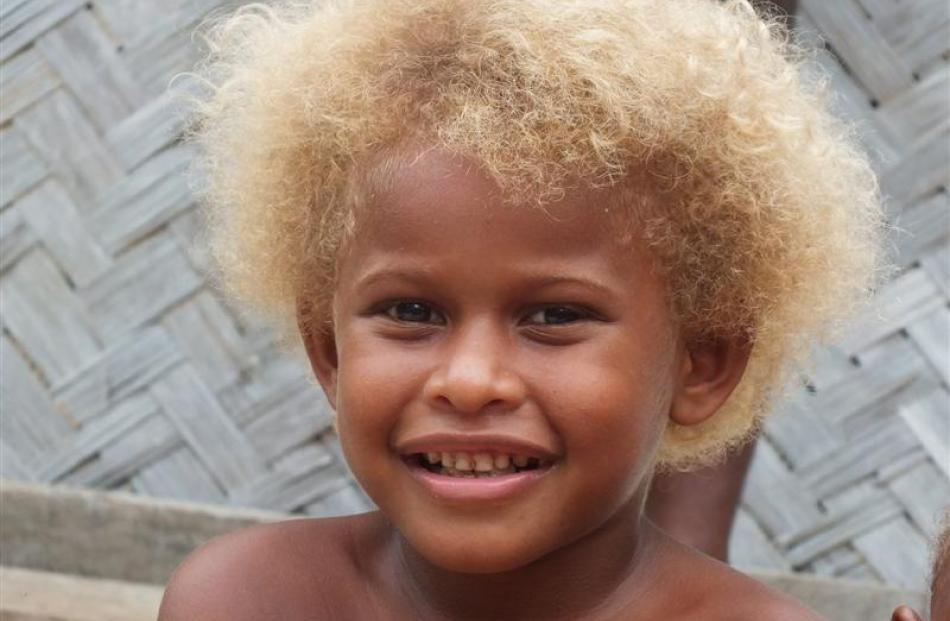 The gene that gives this youngster blond hair is unique to the region.