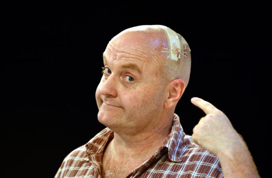 Actor Phil Vaughan shows off his injury at the Fortune Theatre yesterday. Photo by Peter McIntosh.
